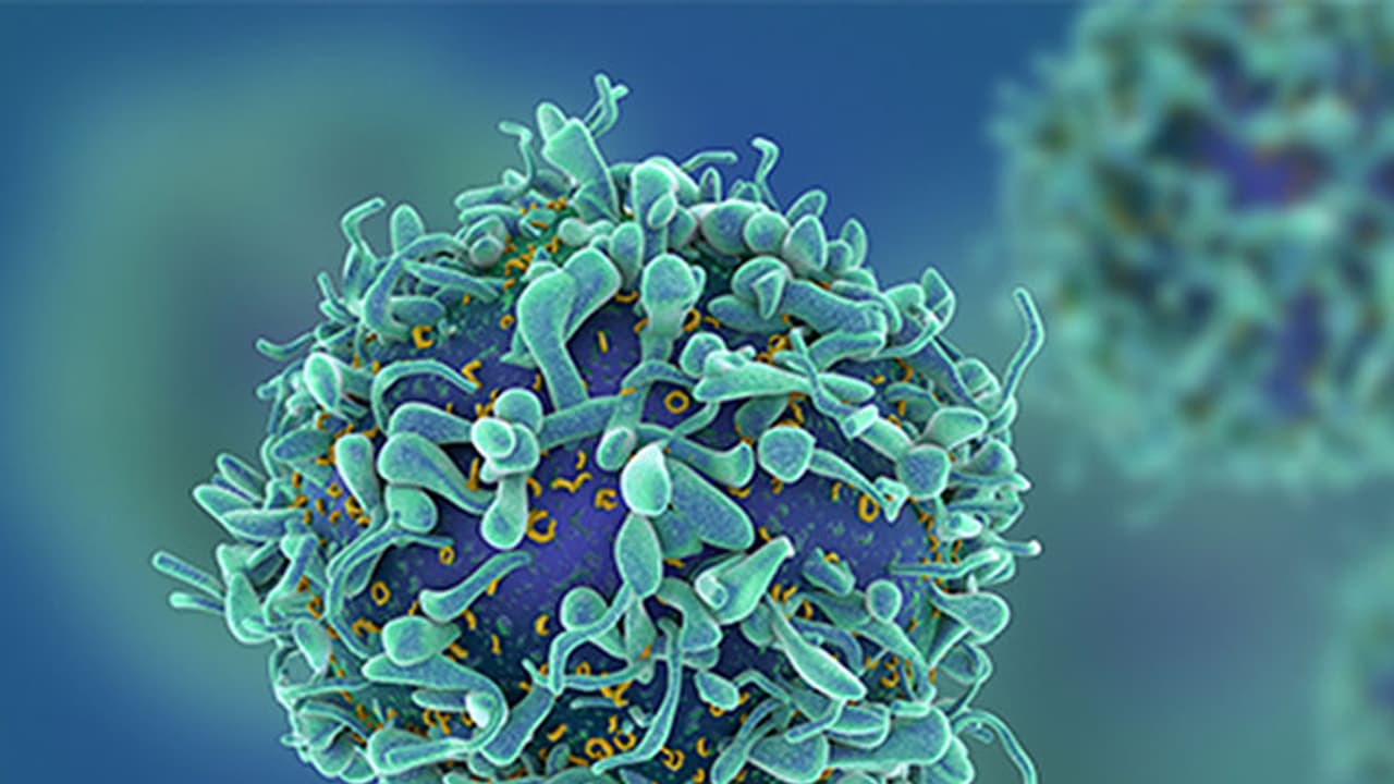 കുടലിലെ ക്യാന്സറിനെ തടയാന് ഇവ കഴിക്കാം കുടലിലെ ക്യാന്സറിനെ തടയാന് ഇവ കഴിക്കാം