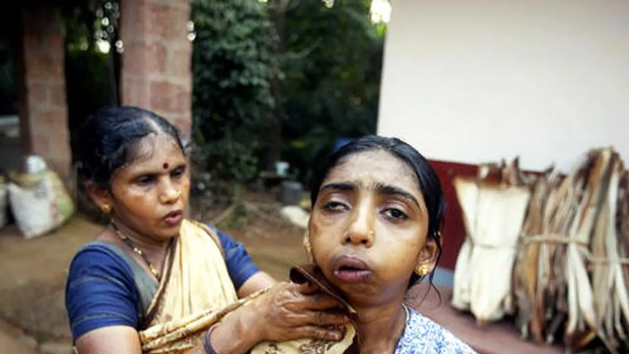 Karnataka: No relief in sight for Endosulfan victims Karnataka: No relief in sight for Endosulfan victims