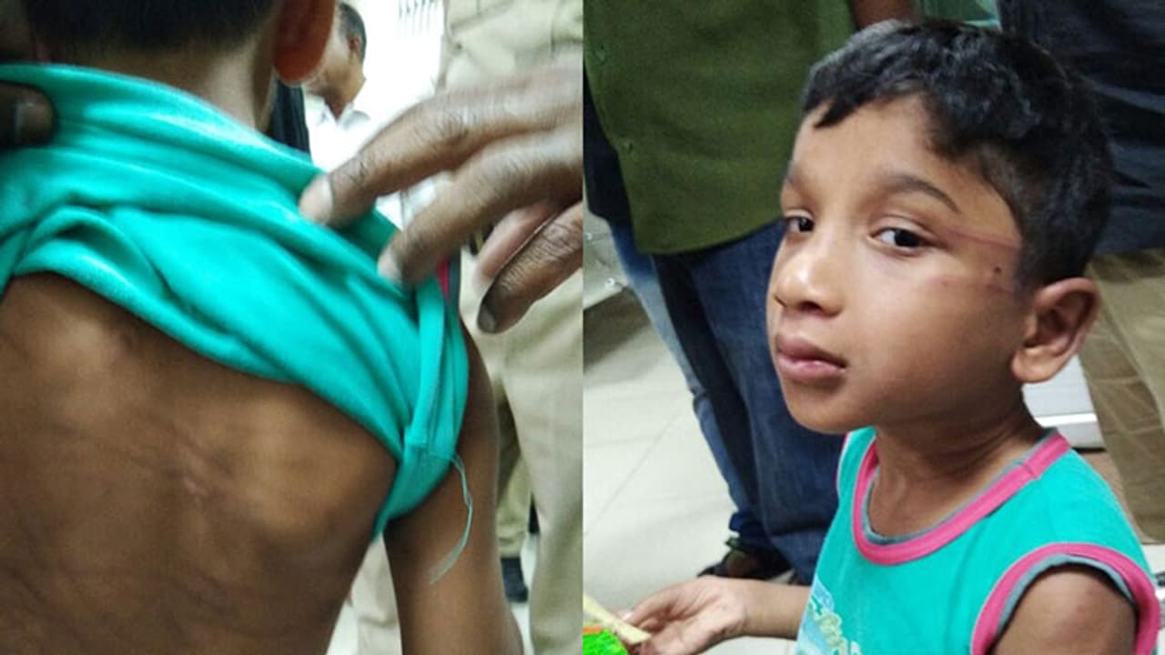 చిన్నారి బాలున్ని చితకబాదిన కన్నతల్లి, ఆమె ప్రియుడు చిన్నారి బాలున్ని చితకబాదిన కన్నతల్లి, ఆమె ప్రియుడు