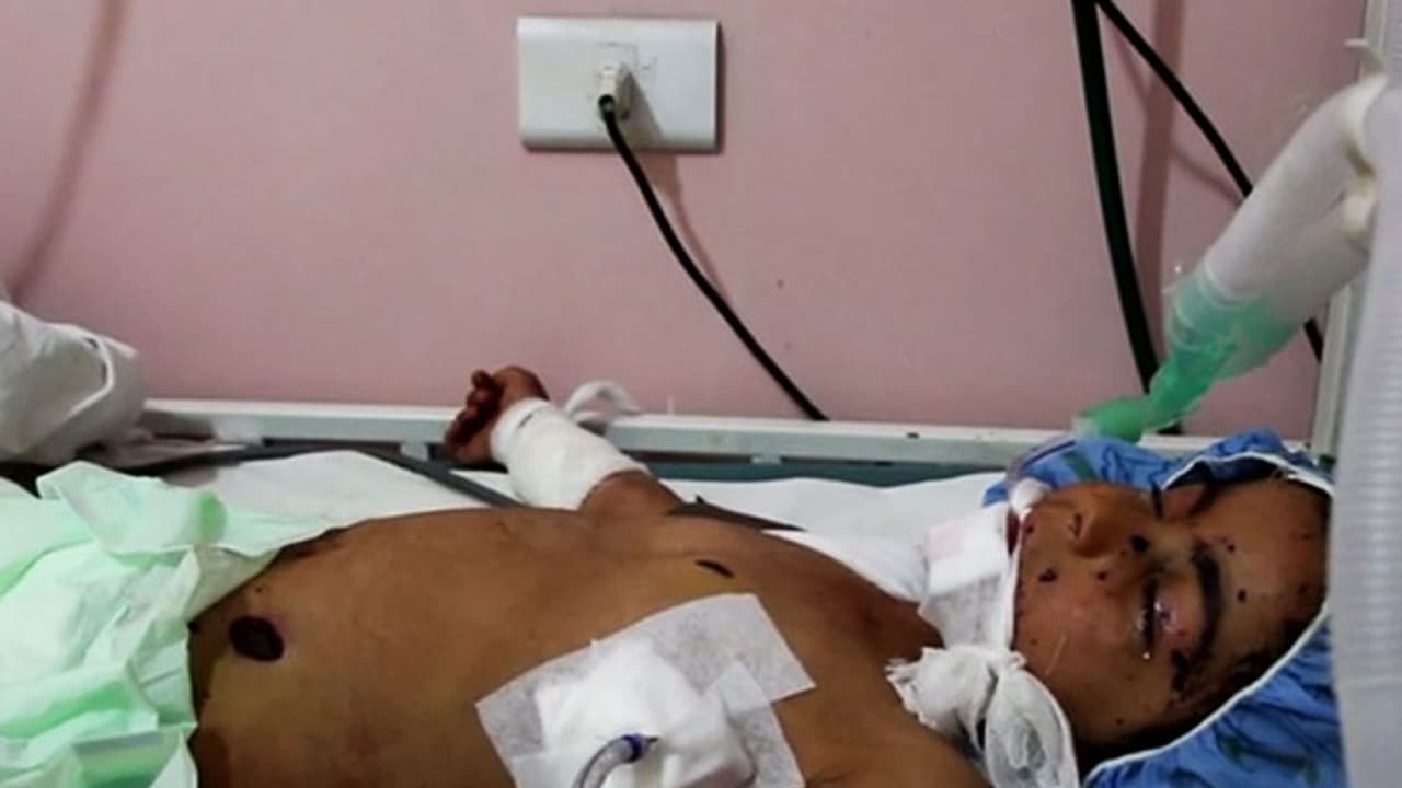 അത് കളിപ്പാട്ടമായിരുന്നില്ല, ബോംബ്!