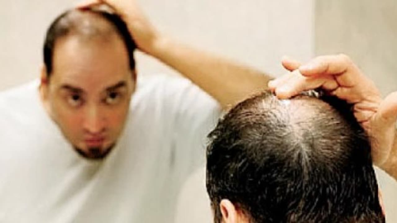 வழுக்கைத் தலையில் முடி வளரனுமா? இந்த டிப்ஸை ஃபாலோ பண்ணுங்க... வழுக்கைத் தலையில் முடி வளரனுமா? இந்த டிப்ஸை ஃபாலோ பண்ணுங்க...