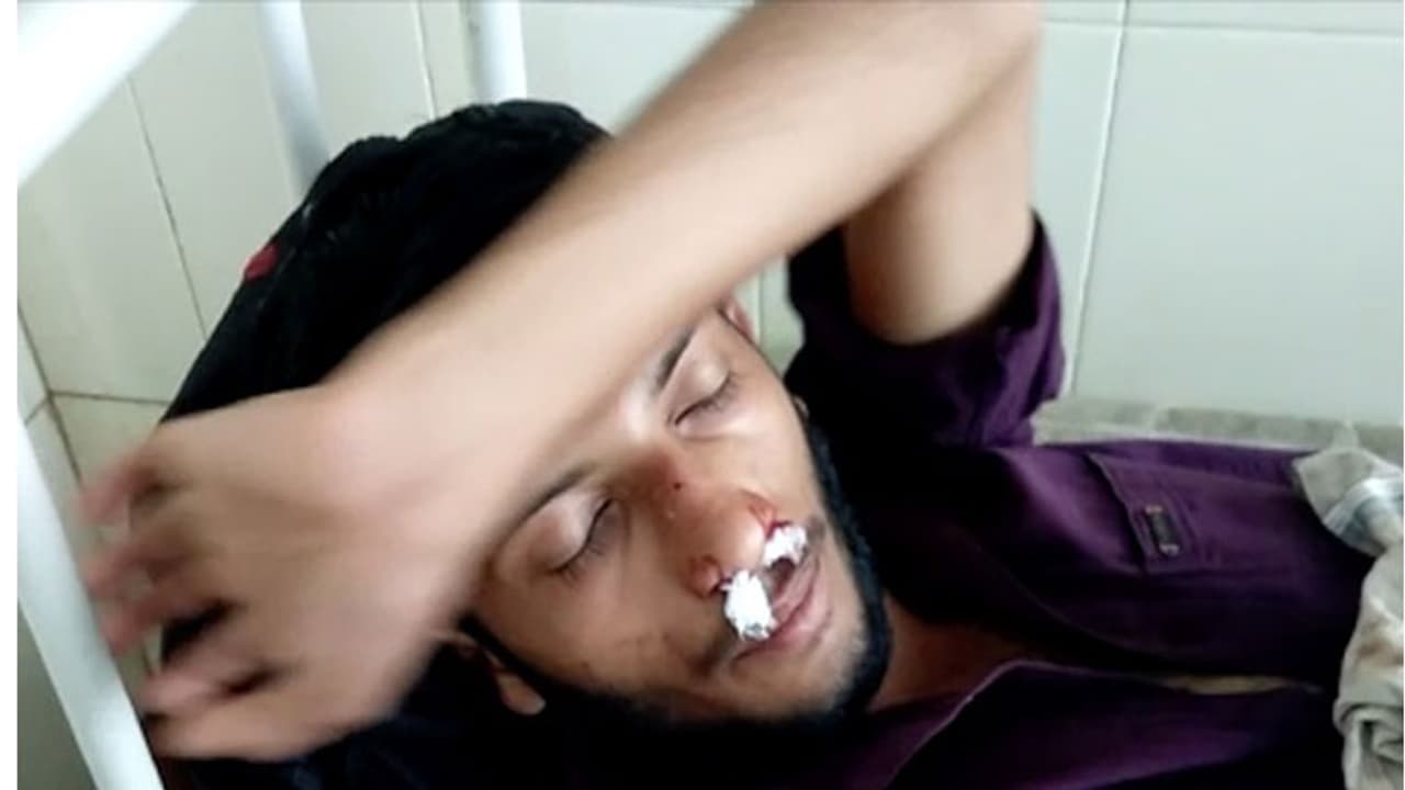 വിദ്യാർത്ഥിയെ ബസ് ജീവനക്കാരൻ മർദ്ദിച്ചു, മൂക്കിന് ഗുരുതരമായി പരുക്ക്