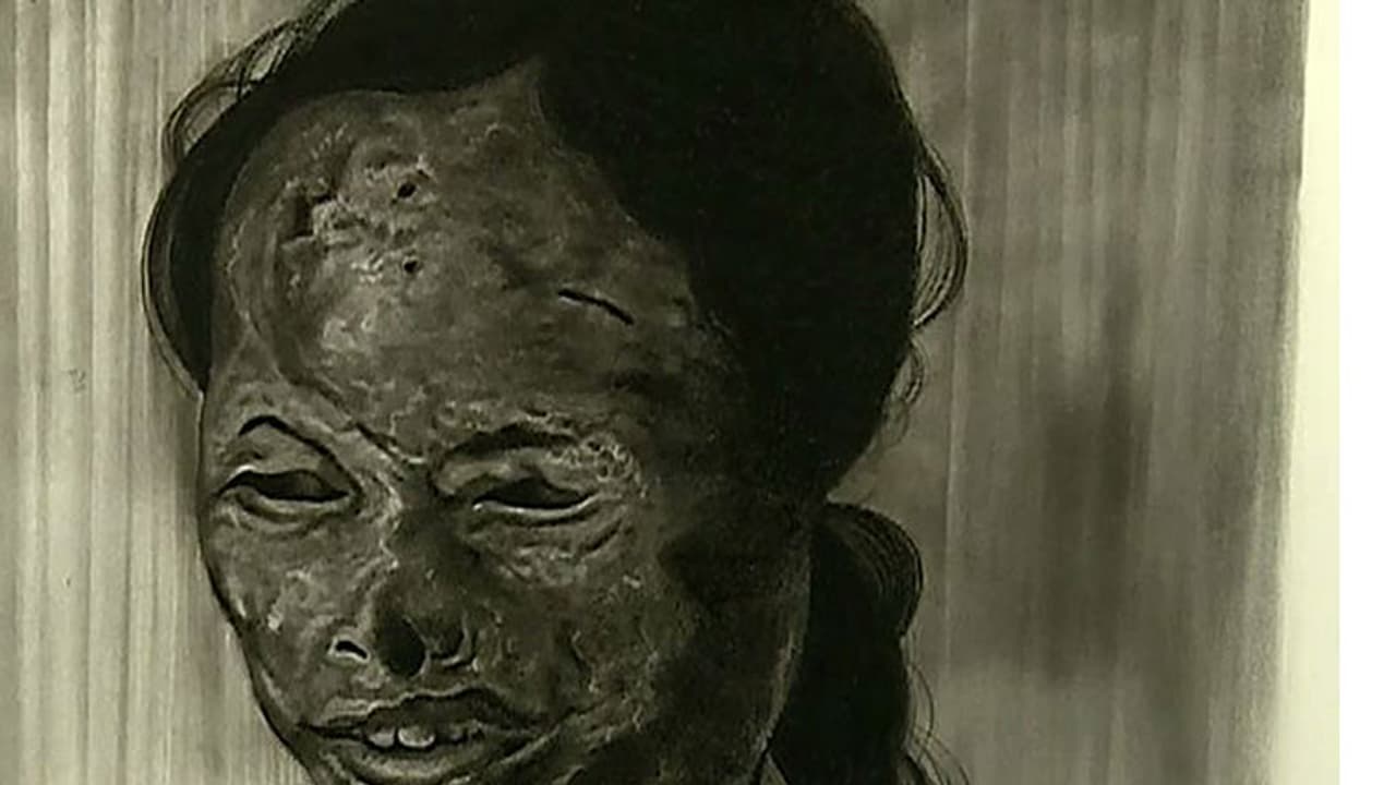 వరంగల్ లో అమ్మాయిపై యాసిడ్ దాడి వరంగల్ లో అమ్మాయిపై యాసిడ్ దాడి