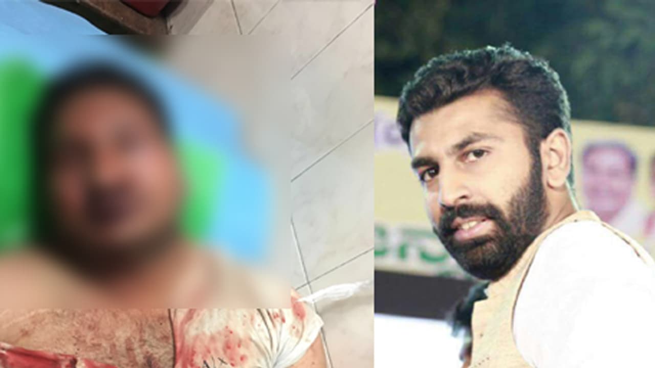 ಮಲ್ಯ ಆಸ್ಪತ್ರೆಯಿಂದ ವಿದ್ವತ್ ಬಿಡುಗಡೆ