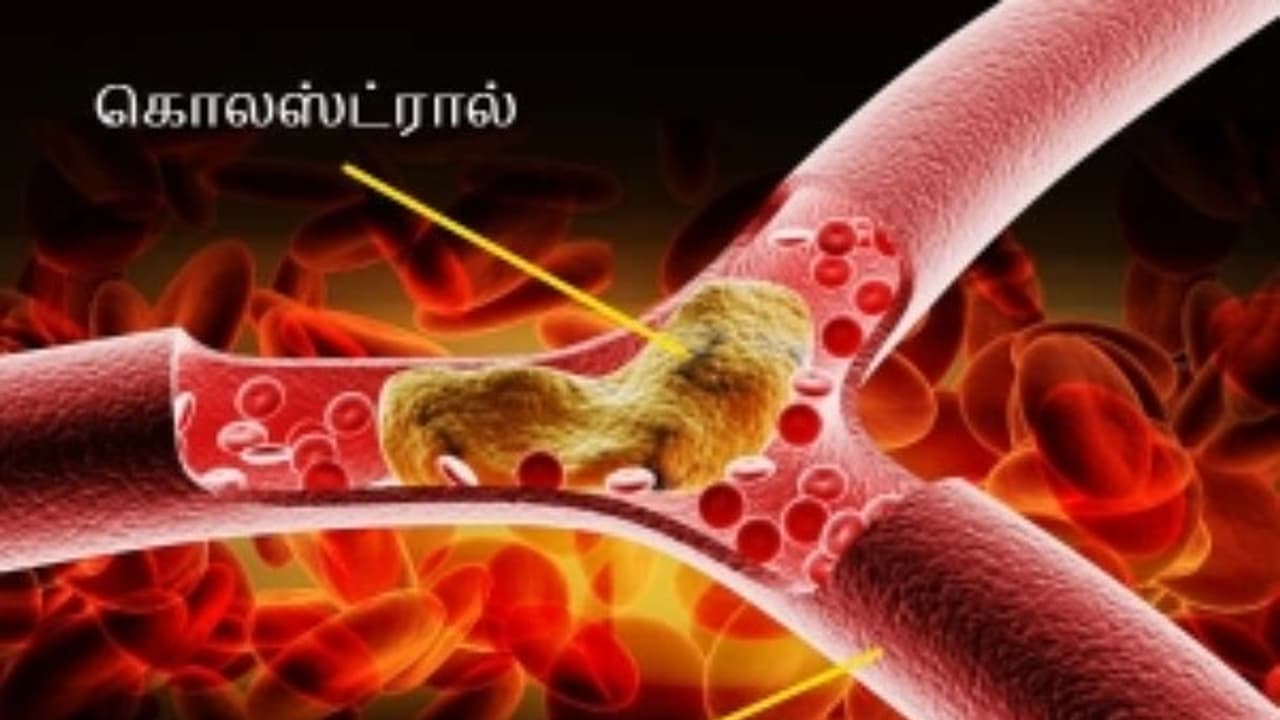 கொலஸ்ட்ரால் பிரச்சனையை இரண்டே வாரத்தில் குறைக்க உதவும் வீட்டு மருந்து... கொலஸ்ட்ரால் பிரச்சனையை இரண்டே வாரத்தில் குறைக்க உதவும் வீட்டு மருந்து...