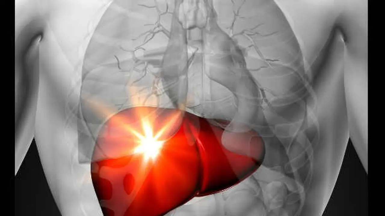 உங்கள் கல்லீரல் பாதிக்கப்பட்டுள்ளதா? என்பதை இந்த அறிகுறிகளை வைத்து கண்டுபிடிக்கலாம்? தீர்வும் இருக்குங்க... உங்கள் கல்லீரல் பாதிக்கப்பட்டுள்ளதா? என்பதை இந்த அறிகுறிகளை வைத்து கண்டுபிடிக்கலாம்? தீர்வும் இருக்குங்க...