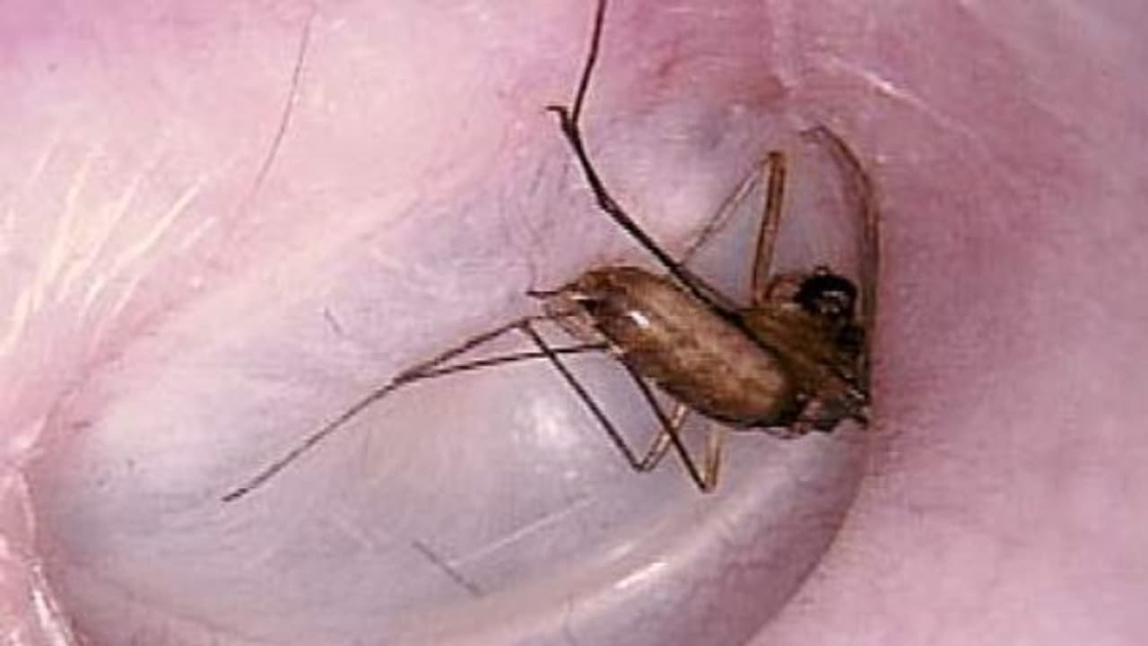 உங்களுக்குத் தெரியுமா? காதினுள் புகுந்த பூச்சியை எடுக்க உப்புக் கரைசல் உதவும்... உங்களுக்குத் தெரியுமா? காதினுள் புகுந்த பூச்சியை எடுக்க உப்புக் கரைசல் உதவும்...