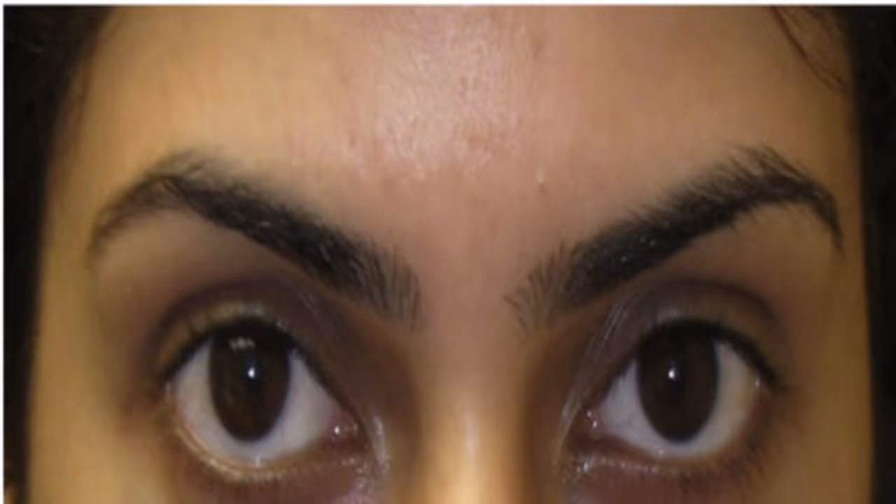 லேடிஸ் அண்ட் ஜென்டில்மேன்...! கண்ணுக்கு கீழே கருவளையமா..? சூப்பர் தீர்வு இதோ.... லேடிஸ் அண்ட் ஜென்டில்மேன்...! கண்ணுக்கு கீழே கருவளையமா..? சூப்பர் தீர்வு இதோ....