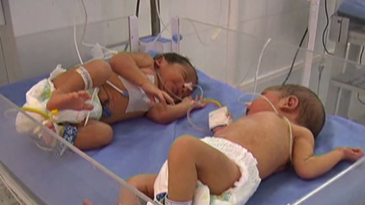 ಕಲಬುರಗಿ ಜಿಲ್ಲಾಸ್ಪತ್ರೆಯ ದಿಟ್ಟ ಹೆಜ್ಜೆ : ಮಗು ಅದಲು ಬದಲು ತಡೆಗೆ 'ಬೇಬಿ ಬ್ಯಾಂಡ್'