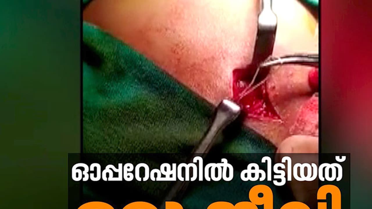 ശസ്ത്രക്രിയയില് യുവാവിന്റെ മുഖത്തു നിന്നും പുറത്തെടുത്തത് ജീവനുള്ള വിര! ശസ്ത്രക്രിയയില് യുവാവിന്റെ മുഖത്തു നിന്നും പുറത്തെടുത്തത് ജീവനുള്ള വിര!