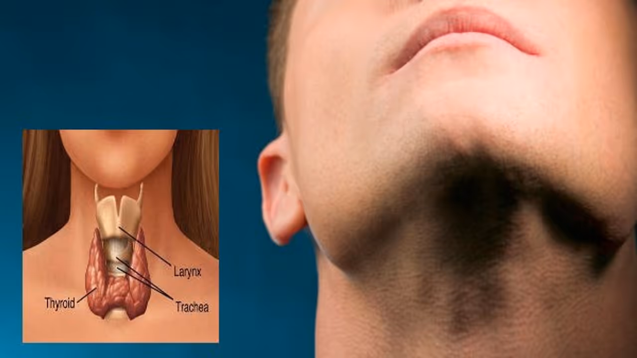 உஷார்: இந்த அறிகுறிகள் இருந்தால் உங்களுக்கு தைராய்டு இருக்குனு அர்த்தம்… உஷார்: இந்த அறிகுறிகள் இருந்தால் உங்களுக்கு தைராய்டு இருக்குனு அர்த்தம்…