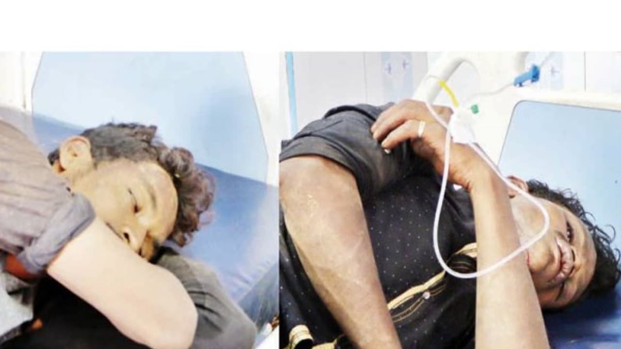 நகையை பறித்த திருடர்களுக்கு தரும அடி; போலீஸ்க்கு தகவல் கொடுத்துவிட்டு மருத்துவமனையில் சேர்த்த மக்கள்... நகையை பறித்த திருடர்களுக்கு தரும அடி; போலீஸ்க்கு தகவல் கொடுத்துவிட்டு மருத்துவமனையில் சேர்த்த மக்கள்...