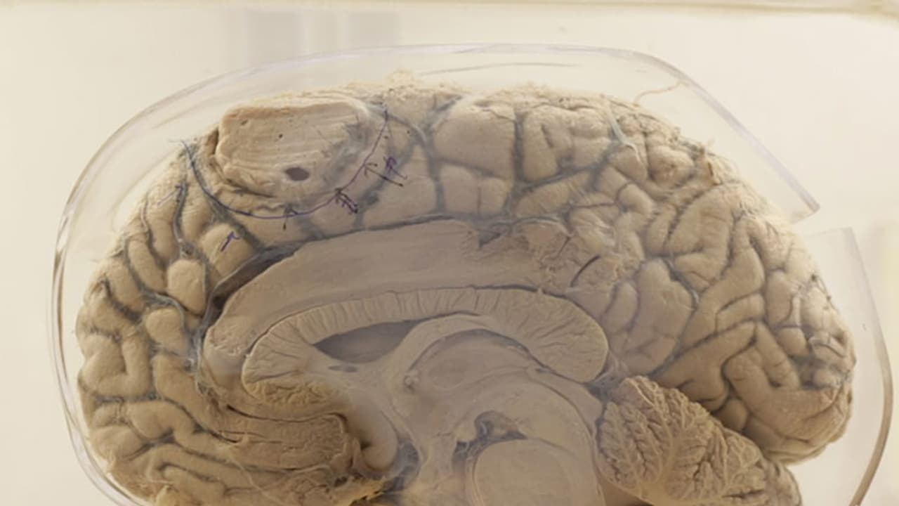 സൂക്ഷിക്കുക, നിങ്ങളുടെ തലച്ചോറിനെ തലച്ചോറ് തന്നെ ഭക്ഷിക്കും! സൂക്ഷിക്കുക, നിങ്ങളുടെ തലച്ചോറിനെ തലച്ചോറ് തന്നെ ഭക്ഷിക്കും!