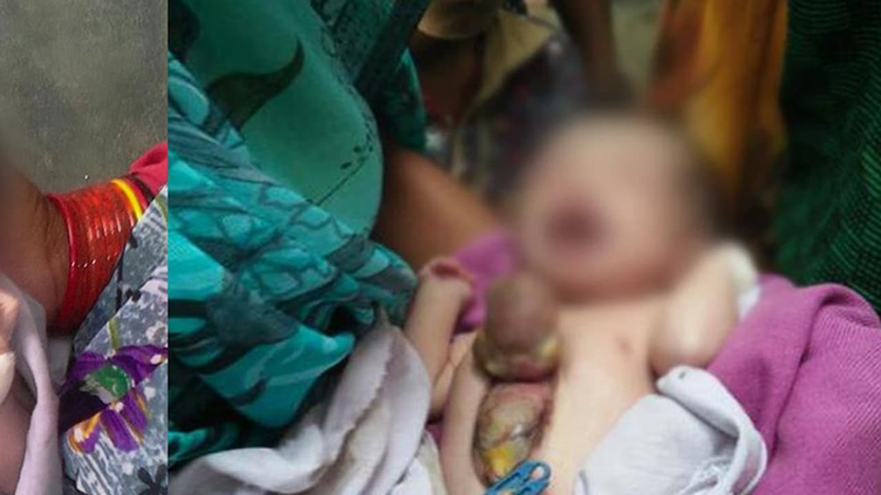 (ವಿಡಿಯೋ)ಎದೆಯ ಹೊರಗಿದೆ ಈ ಕಂದಮ್ಮನ ಹೃದಯ: ಬಡಿತ ನೋಡಿದ ವೈದ್ಯರಿಗೇ ಶಾಕ್! (ವಿಡಿಯೋ)ಎದೆಯ ಹೊರಗಿದೆ ಈ ಕಂದಮ್ಮನ ಹೃದಯ: ಬಡಿತ ನೋಡಿದ ವೈದ್ಯರಿಗೇ ಶಾಕ್!