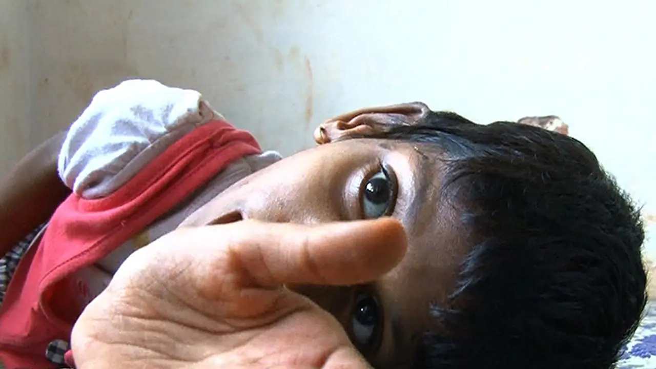 'എന്ഡോസള്ഫാന് ഇരകൾക്കുള്ള ചികിത്സ നിരീക്ഷിക്കണം' ഹൈക്കോടതി പ്രത്യേക ബെഞ്ച് രൂപീകരിക്കണമെന്ന് സുപ്രീംകോടതി 'എന്ഡോസള്ഫാന് ഇരകൾക്കുള്ള ചികിത്സ നിരീക്ഷിക്കണം' ഹൈക്കോടതി പ്രത്യേക ബെഞ്ച് രൂപീകരിക്കണമെന്ന് സുപ്രീംകോടതി