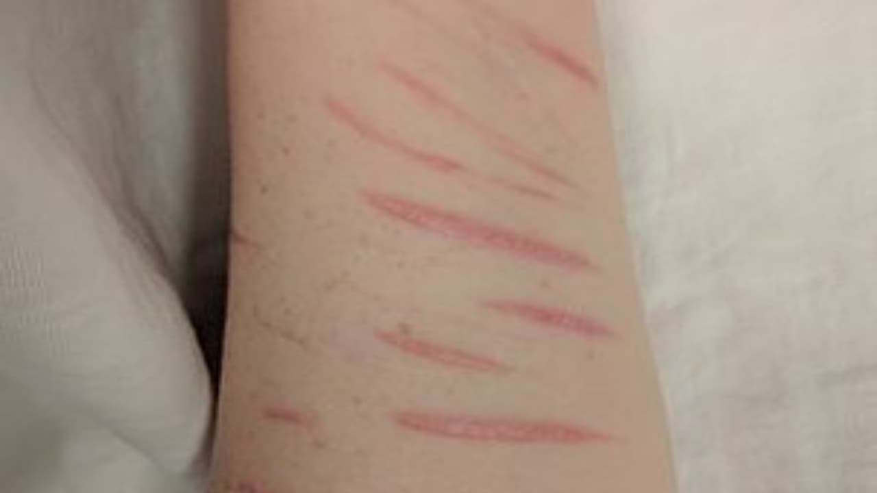 నీ భార్యను ప్రేమిస్తున్నాను... అడ్డు తప్పుకోమంటూ భర్తపై బ్లేడ్ తో దాడి నీ భార్యను ప్రేమిస్తున్నాను... అడ్డు తప్పుకోమంటూ భర్తపై బ్లేడ్ తో దాడి