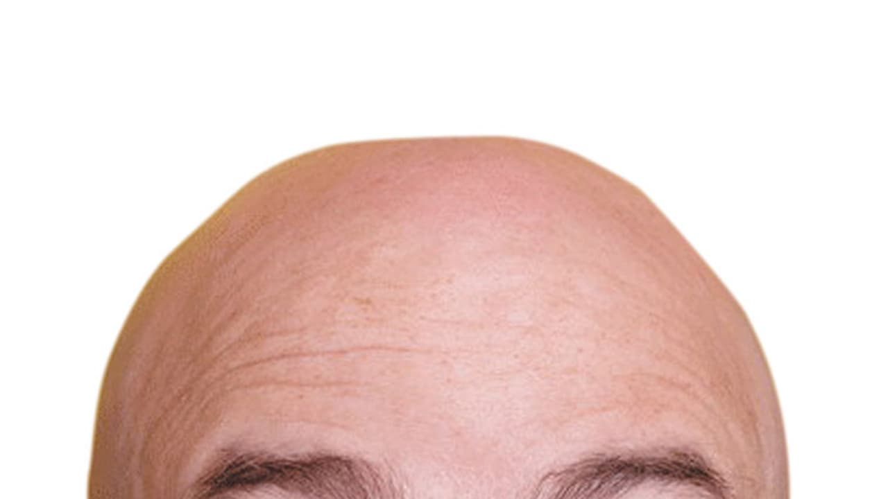 ಬೋಳು ತಲೆ ಸಮಸ್ಯೆಯೇ? ಈ ಗ್ರಹವನ್ನು ಶಾಂತಗೊಳಿಸಿ ನೋಡಿ, ಕೂದಲು ಉದುರೋದು ನಿಂತೀತು!