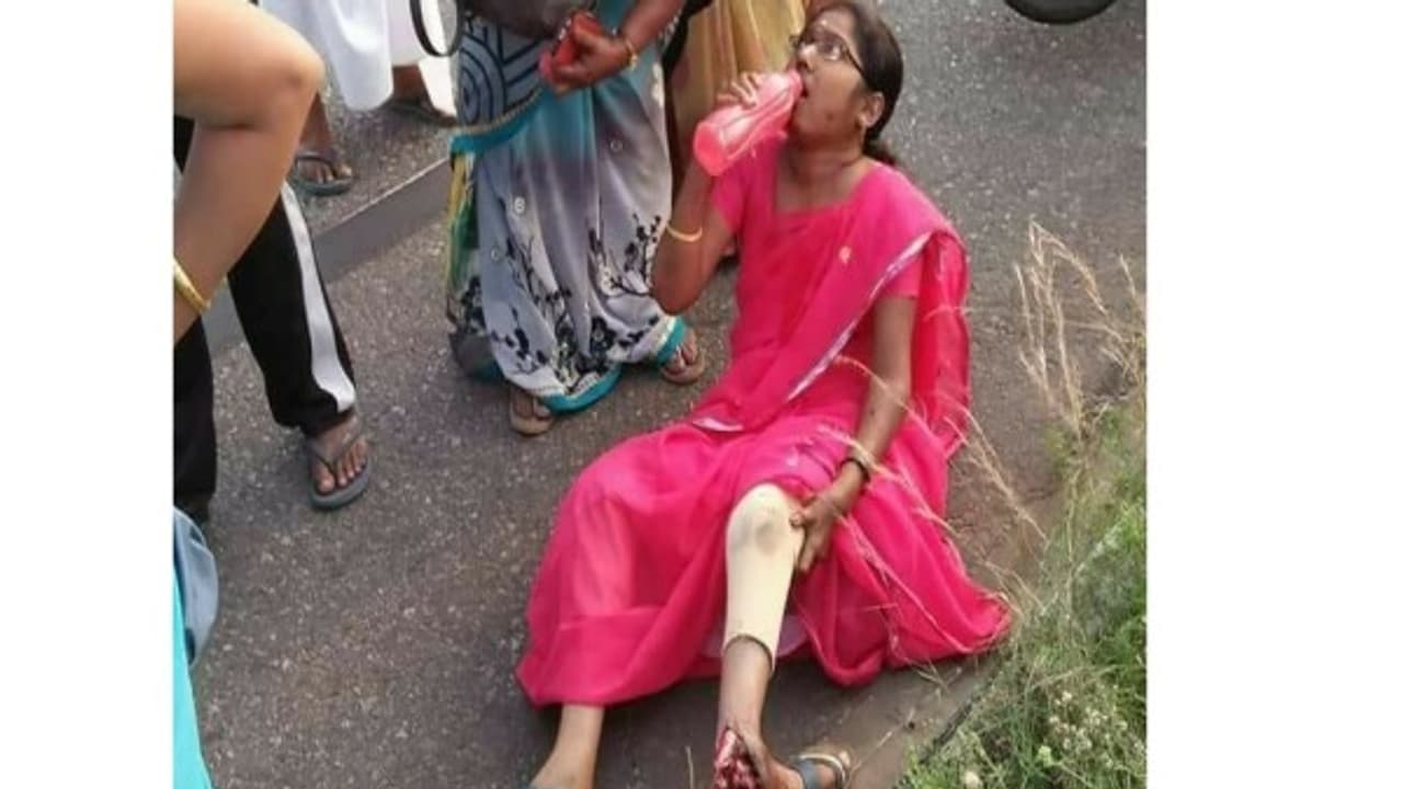 ஆசிரியையின் கழுத்தில் இருந்த செயினை அறுத்துவிட்டு கீழே தள்ளிய திருடர்கள்... இரண்டாக முறிந்த கால்.... ஆசிரியையின் கழுத்தில் இருந்த செயினை அறுத்துவிட்டு கீழே தள்ளிய திருடர்கள்... இரண்டாக முறிந்த கால்....