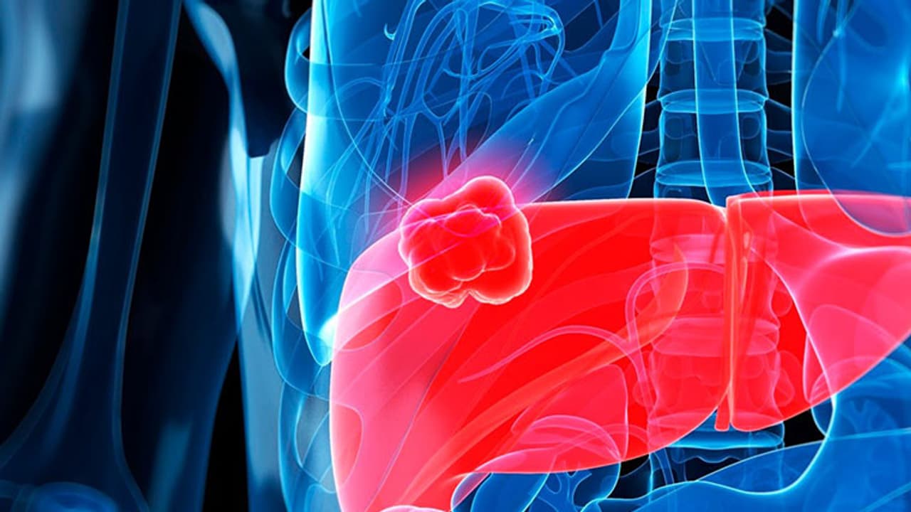 നിങ്ങളുടെ കരള് അപകടത്തിലാണ് 5 പ്രാരംഭ ലക്ഷണങ്ങള് ശ്രദ്ധിക്കൂ... നിങ്ങളുടെ കരള് അപകടത്തിലാണ് 5 പ്രാരംഭ ലക്ഷണങ്ങള് ശ്രദ്ധിക്കൂ...