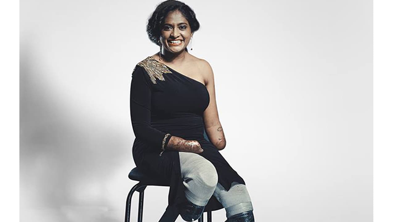 ಕೈಕಾಲು ಕಳೆದುಕೊಂಡು ವಿಧಿಗೆ ಸವಾಲೆಸೆದ ಹುಡುಗಿ ಕೈಕಾಲು ಕಳೆದುಕೊಂಡು ವಿಧಿಗೆ ಸವಾಲೆಸೆದ ಹುಡುಗಿ