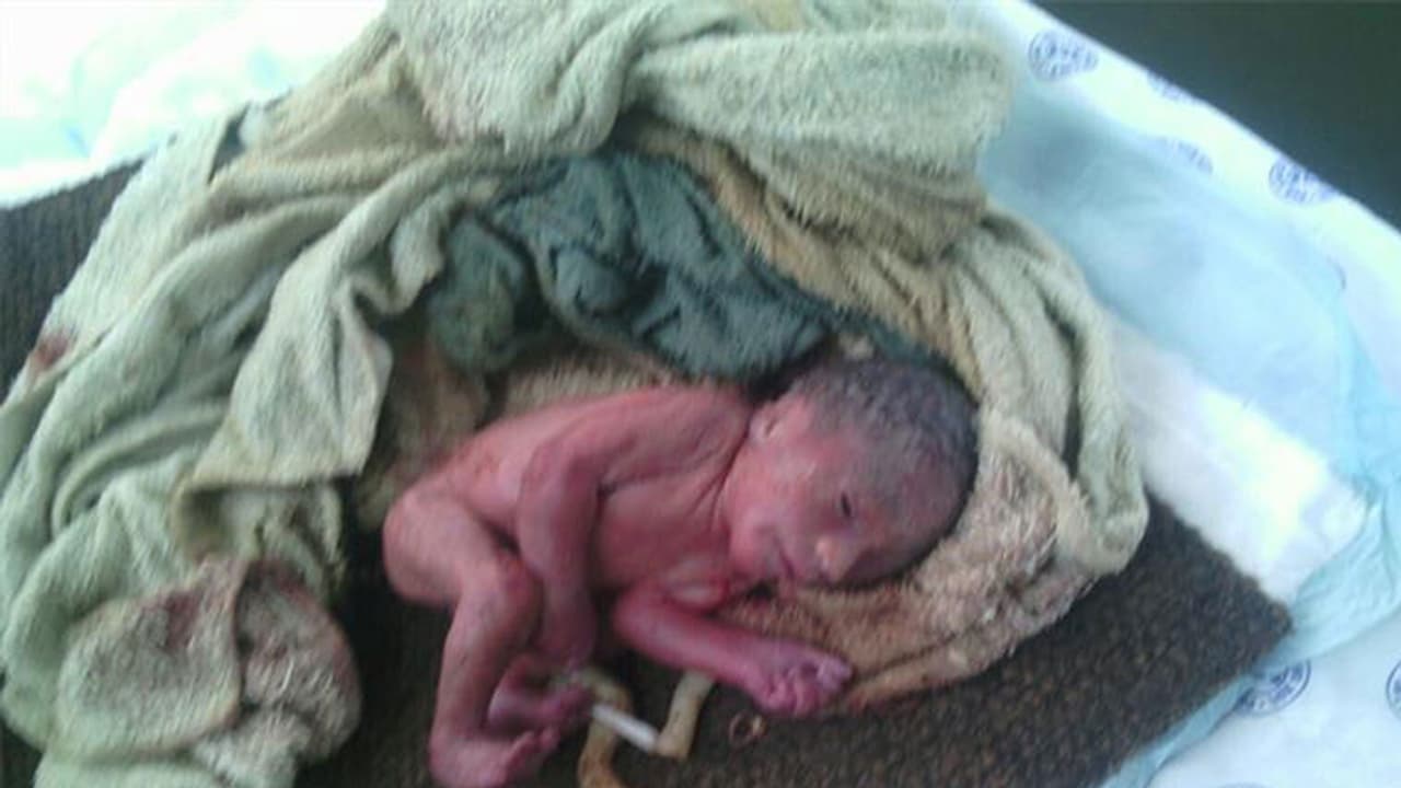 ఈ చిన్నారి చావుకి కారణమెవరు ? ఈ చిన్నారి చావుకి కారణమెవరు ?