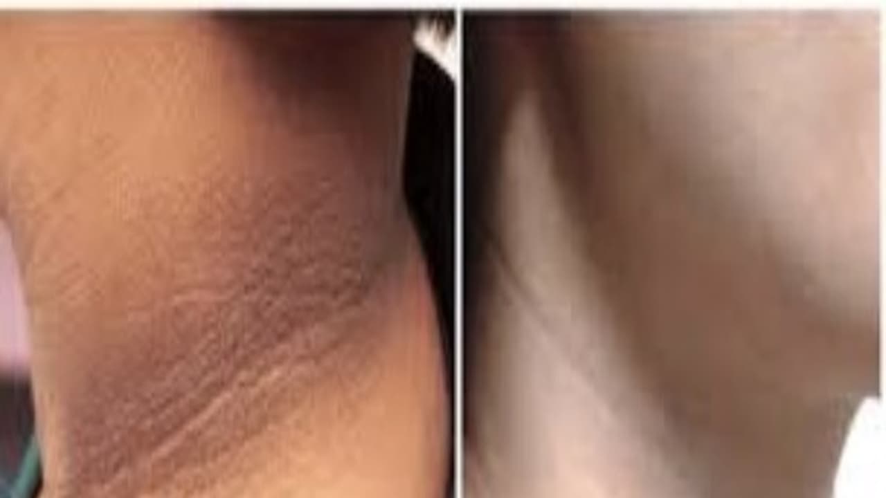 உங்களுக்குத் தெரியுமா? ஹார்மோன் மாற்றங்களால் கூட தோல் கருமை அடையும்... உங்களுக்குத் தெரியுமா? ஹார்மோன் மாற்றங்களால் கூட தோல் கருமை அடையும்...