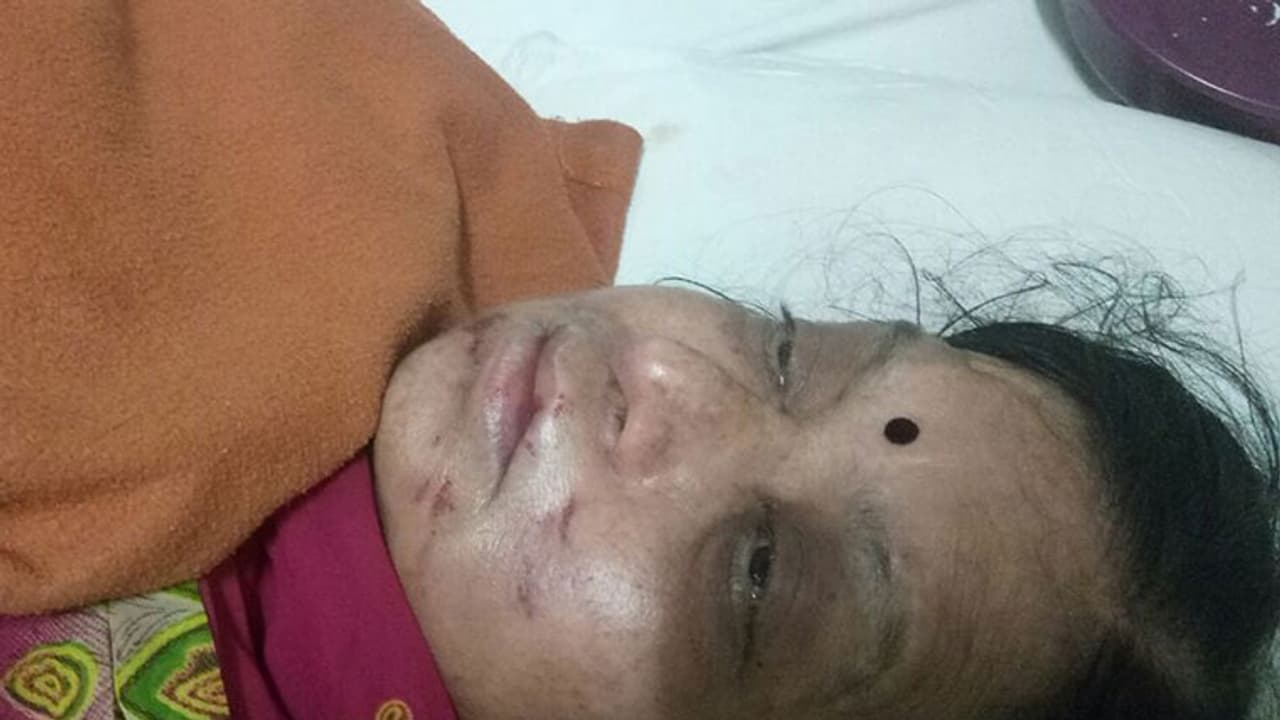 న్యాయమడిగిన వృద్ధురాలిపై దాడి చేశారు న్యాయమడిగిన వృద్ధురాలిపై దాడి చేశారు