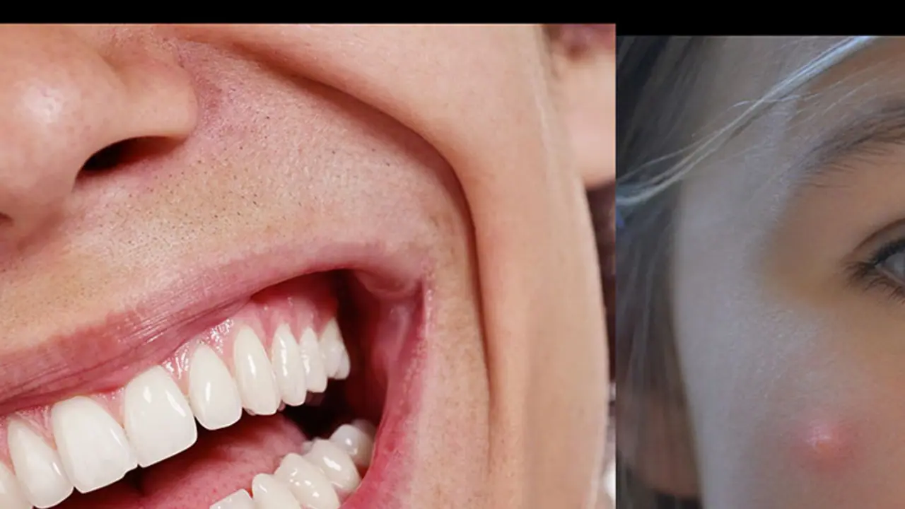 Kerala teacher bites all students in his class as 'prize' for exam marks Kerala teacher bites all students in his class as 'prize' for exam marks