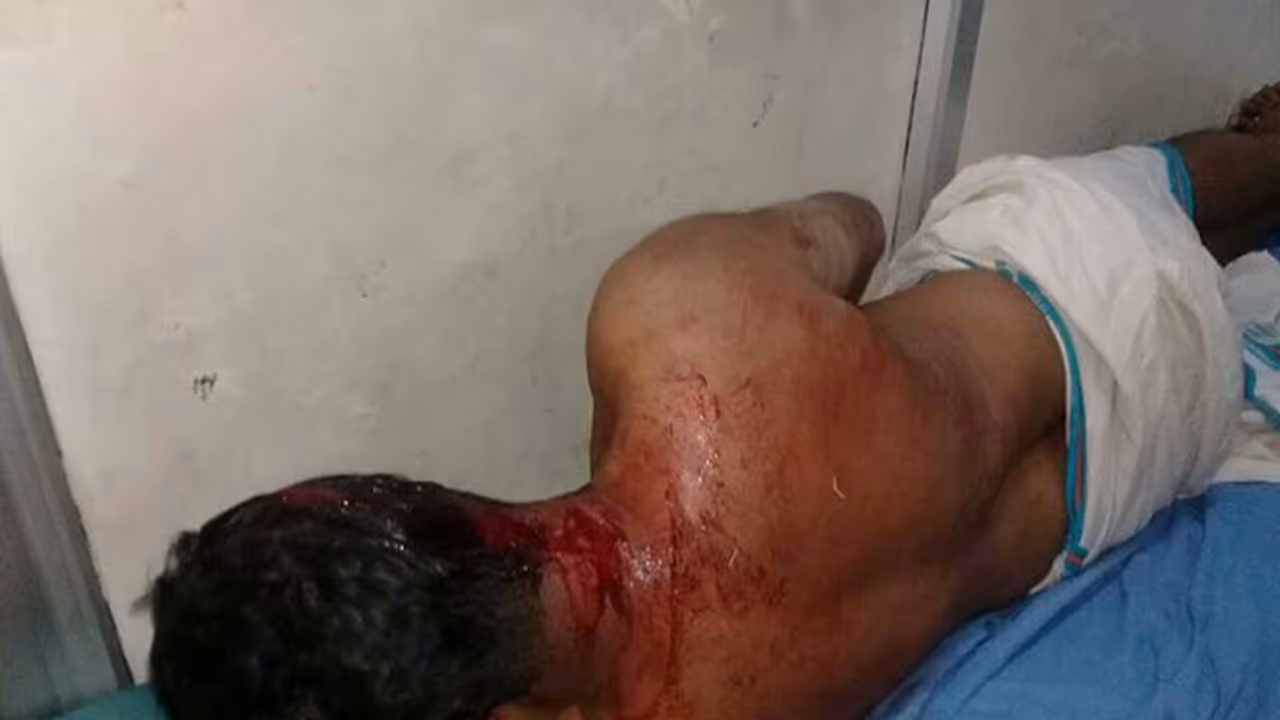 Police officers, CPM workers injured in crude bomb attack, hartal in Kannur today