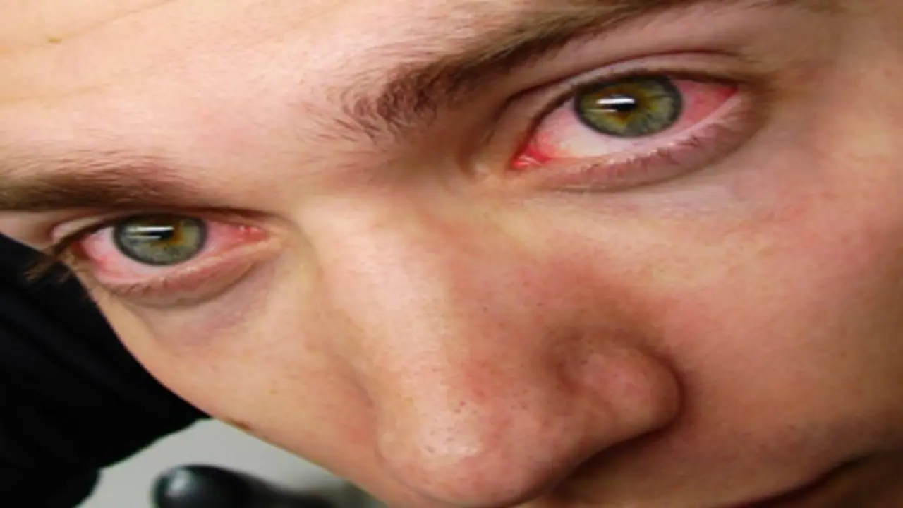 கண் சிவப்பதற்கு மதுவும் ஒரு காரணம் என்று நீங்கள் அறிவீர்களா? கண் சிவப்பதற்கு மதுவும் ஒரு காரணம் என்று நீங்கள் அறிவீர்களா?