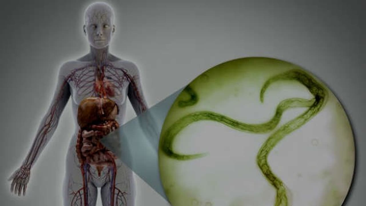 இந்த உணவுப் பொருட்களை கொண்டு குடலில் இருக்கும் ஒட்டுண்ணிகளை வேறோடு அழிக்கலாம்... இந்த உணவுப் பொருட்களை கொண்டு குடலில் இருக்கும் ஒட்டுண்ணிகளை வேறோடு அழிக்கலாம்...