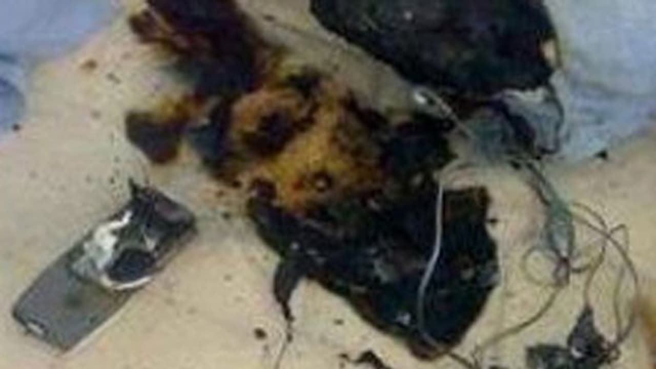 உஷார்..! வெடித்தது செல்போன்..குழந்தைகளிடம் அதிக நேரம் போன் கொடுக்க வேண்டாம்..! உஷார்..! வெடித்தது செல்போன்..குழந்தைகளிடம் அதிக நேரம் போன் கொடுக்க வேண்டாம்..!