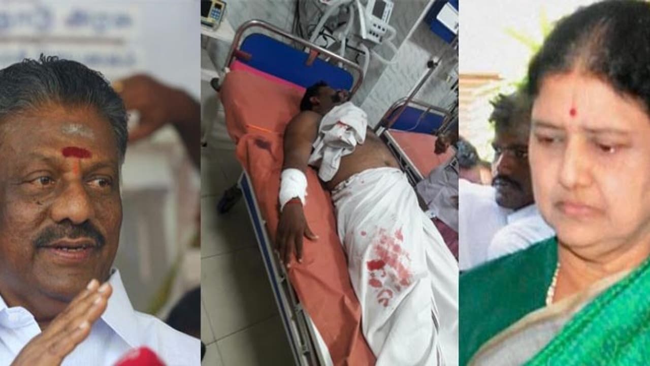 ஒபிஎஸ் ஆதரவாளருக்கு அரிவாள் வெட்டு! சசிகலா ஆதரவாளர் வெறிச்செயல் ஆர் கே நகரில் பதற்றம் ஒபிஎஸ் ஆதரவாளருக்கு அரிவாள் வெட்டு! சசிகலா ஆதரவாளர் வெறிச்செயல் ஆர் கே நகரில் பதற்றம்