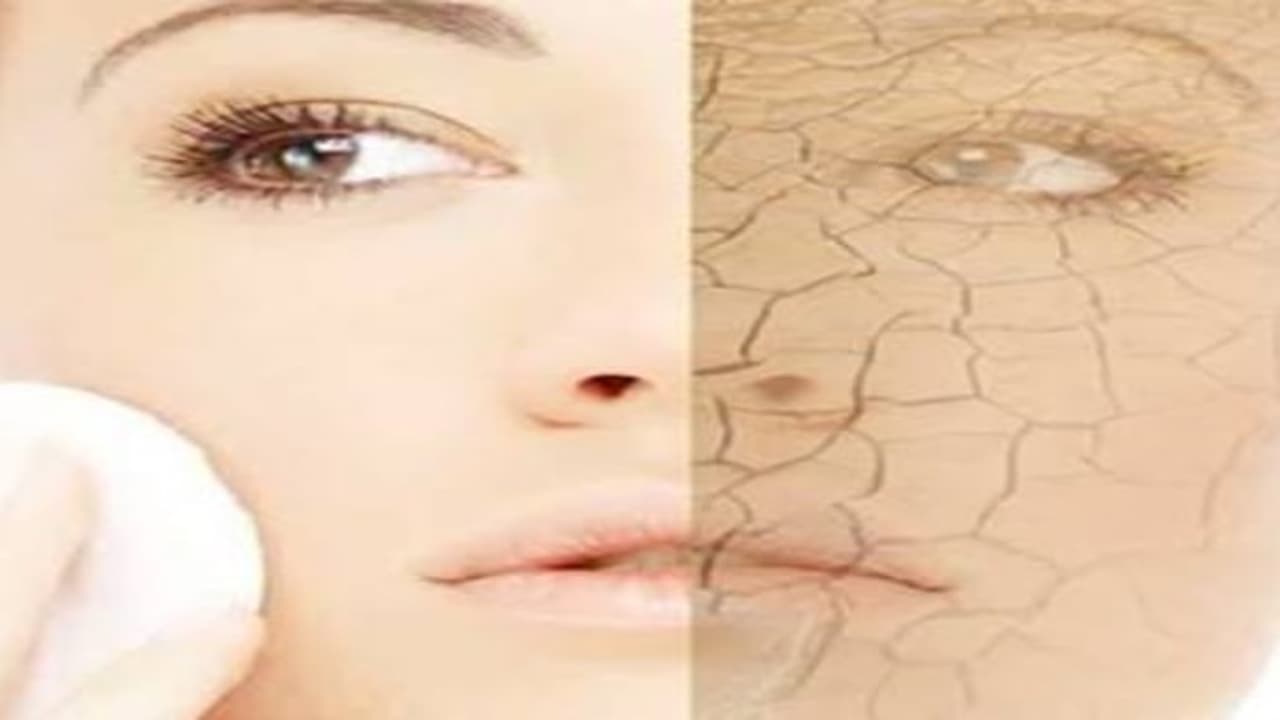 சம்மரில் சரும வறட்சிக்கான காரணத்தை தெரிந்துகொண்டு அதற்கு ஏற்றாற்போல தீர்வு காணலாம்… சம்மரில் சரும வறட்சிக்கான காரணத்தை தெரிந்துகொண்டு அதற்கு ஏற்றாற்போல தீர்வு காணலாம்…