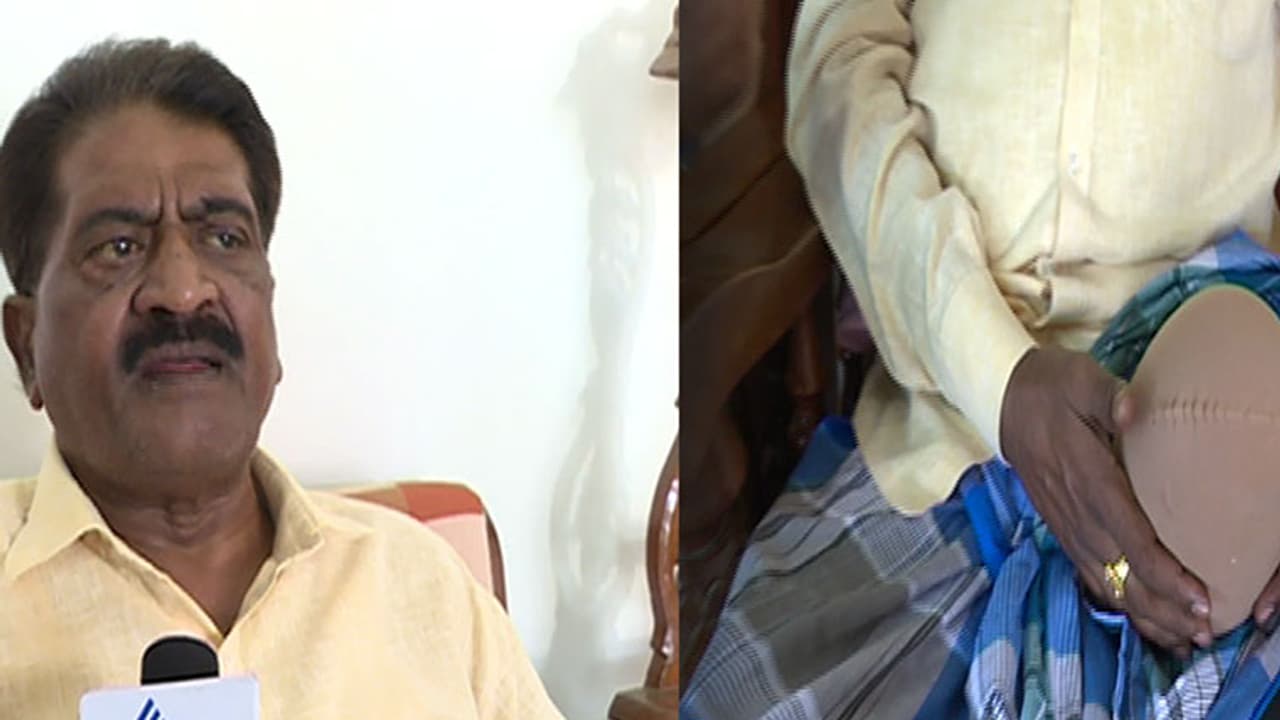 ಗ್ಯಾಂಗ್ರಿನ್`ನಿಂದ ಕಾಲು ಕಳೆದುಕೊಂಡ ನಟ ಸತ್ಯಜಿತ್ ಗ್ಯಾಂಗ್ರಿನ್`ನಿಂದ ಕಾಲು ಕಳೆದುಕೊಂಡ ನಟ ಸತ್ಯಜಿತ್