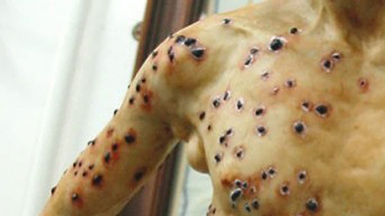 ബ്യൂബോണിക്ക് പ്ലേഗ് ആശങ്ക; വില്ലന്‍ അണ്ണാറക്കണ്ണന്‍