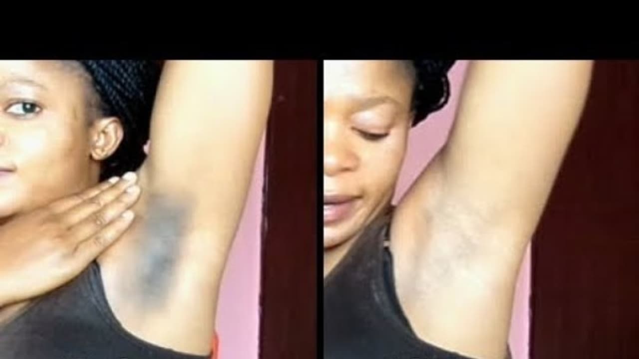 வெறும் 2 நாளில் "அக்குள் கருமை" நீங்கி பளப்பளப்பா "வெண்மையா" மாற வேண்டுமா..? 