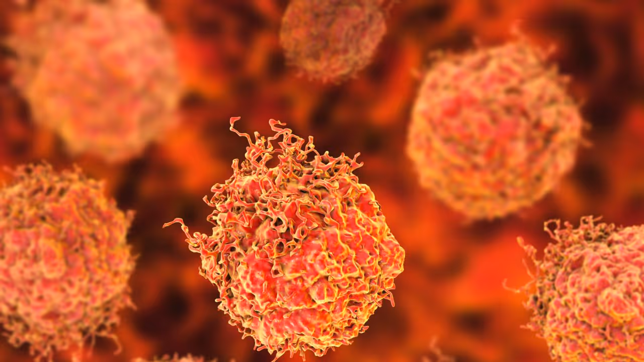 Biomerica Adds Most New Retail Followers Among Biotechs After UAE Nod For Prostate Cancer Screening Test Biomerica Adds Most New Retail Followers Among Biotechs After UAE Nod For Prostate Cancer Screening Test