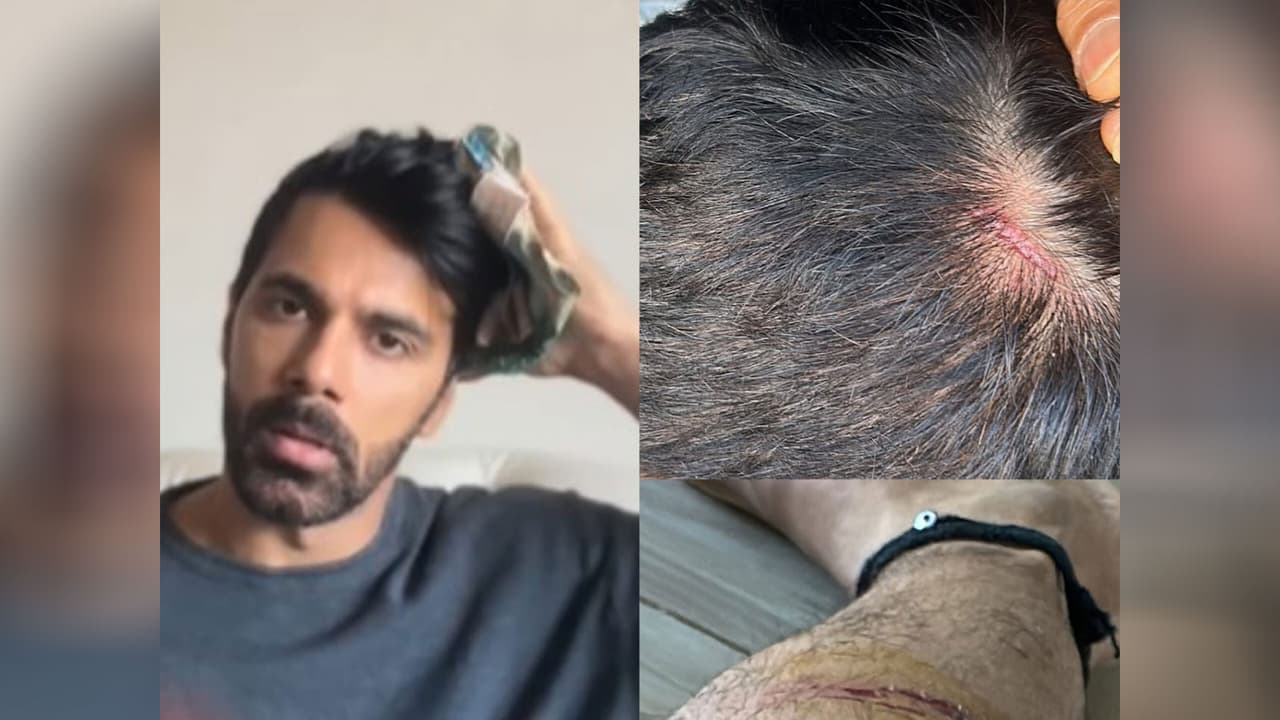 Anuj Sachdeva (Photo/instagram/@apnanuj) Anuj Sachdeva (Photo/instagram/@apnanuj)