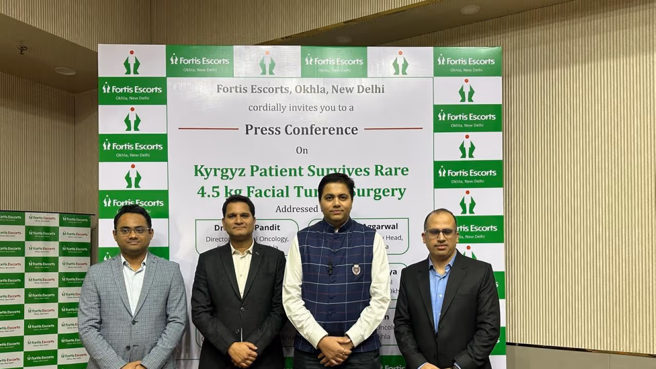 4.5 kg facial tumour successfully removed from Kyrgyz patient in Delhi hospital (Photo/ANI) 4.5 kg facial tumour successfully removed from Kyrgyz patient in Delhi hospital (Photo/ANI)