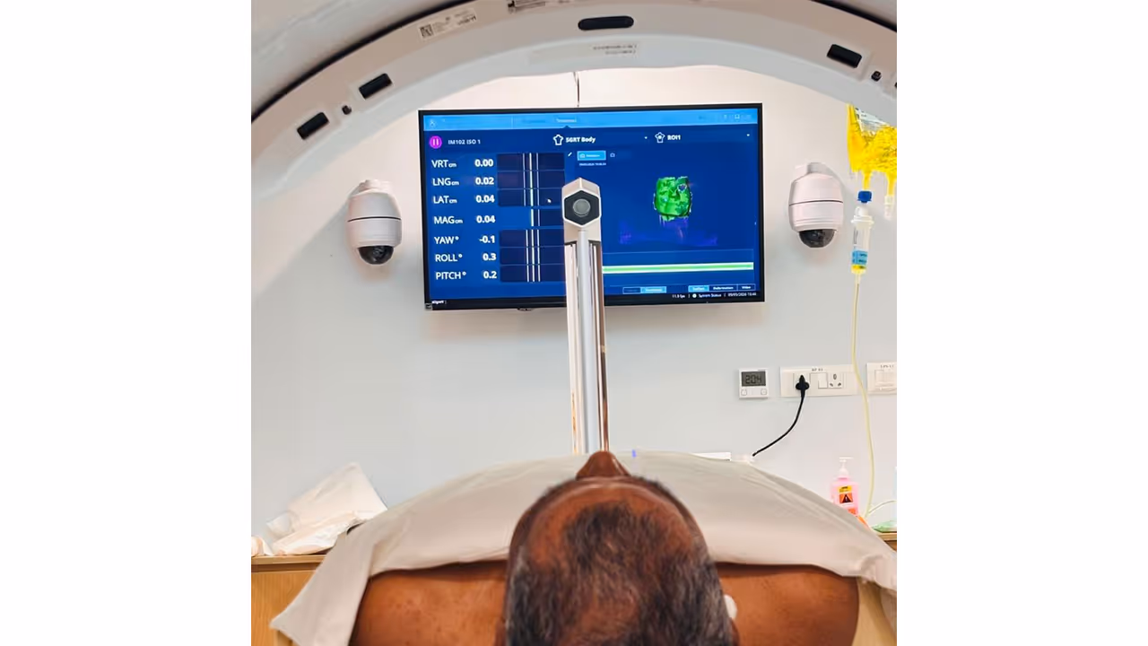 Sir HN Reliance Foundation Hospital achieves AI breakthrough in cancer care with mask free, simulationless radiotherapy (Photo/Sir HN Reliance Foundation Hospital) Sir HN Reliance Foundation Hospital achieves AI breakthrough in cancer care with mask free, simulationless radiotherapy (Photo/Sir HN Reliance Foundation Hospital)