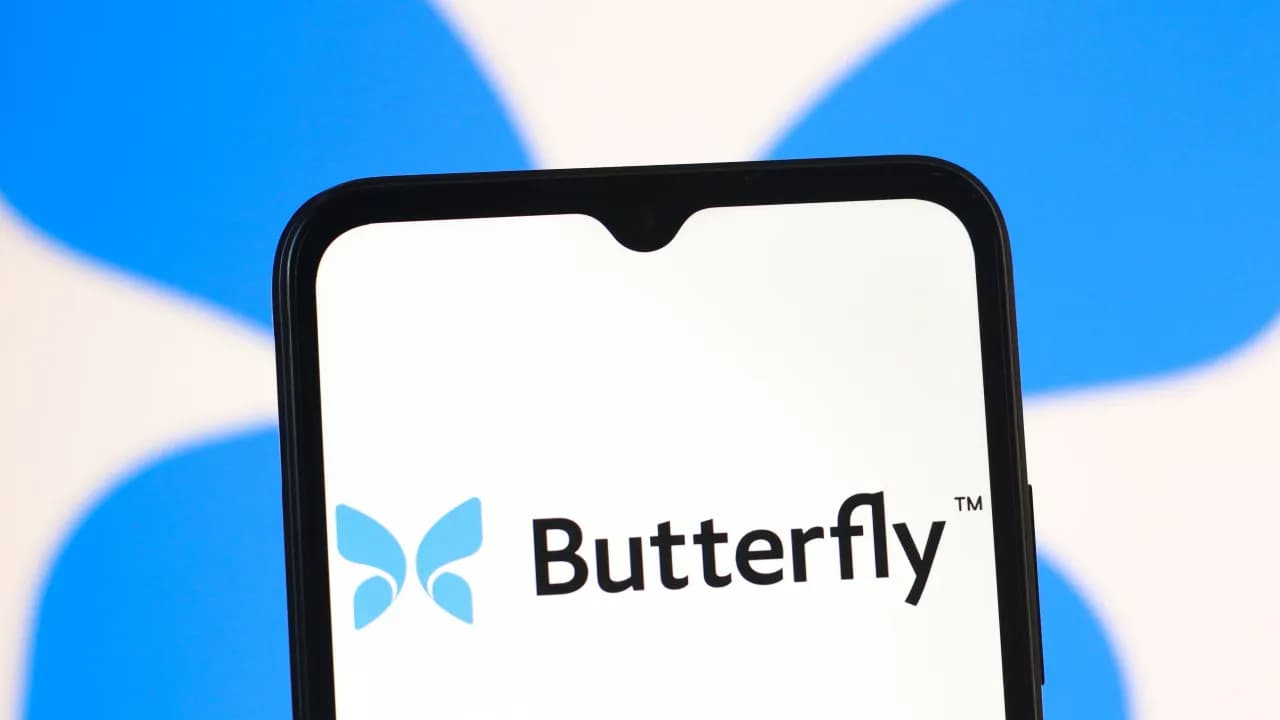 https://stocktwits.com/news articles/markets/equity/bfly michael burry midjourney butterfly tech full body scanner/cZKtmv9R7B3 https://stocktwits.com/news articles/markets/equity/bfly michael burry midjourney butterfly tech full body scanner/cZKtmv9R7B3
