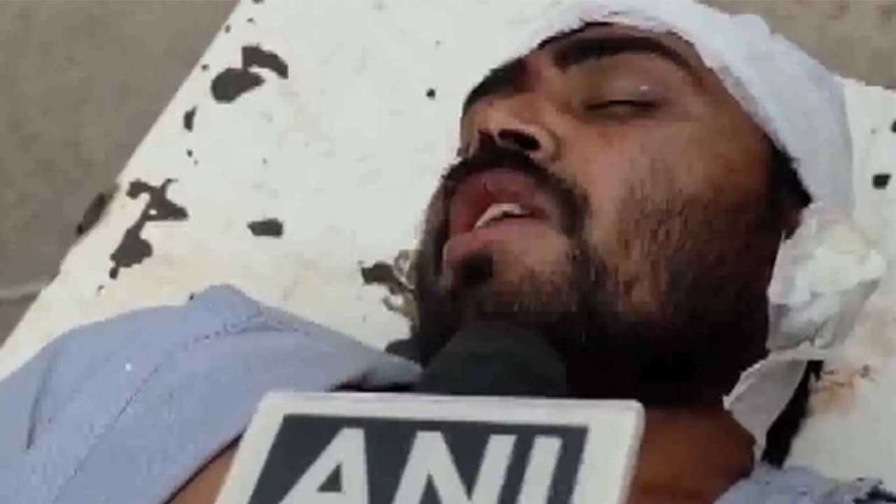 MP: Injured man Motilal Kushwaha (Photo/ANI) MP: Injured man Motilal Kushwaha (Photo/ANI)