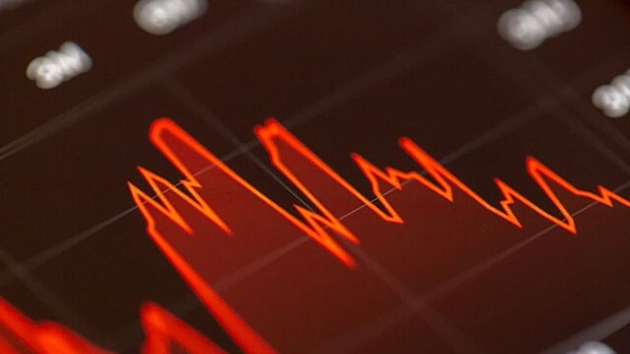 https://stocktwits.com/news articles/markets/equity/eye point regulatory overhang may take time to clear after wet amd trial setback rbc says retail calls eypt slump a huge overreaction/cZYc71bRJSC https://stocktwits.com/news articles/markets/equity/eye point regulatory overhang may take time to clear after wet amd trial setback rbc says retail calls eypt slump a huge overreaction/cZYc71bRJSC