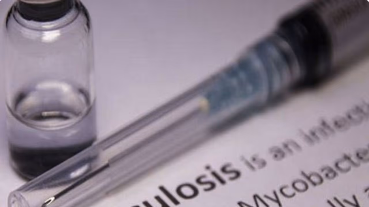 Representative Image Representative Image