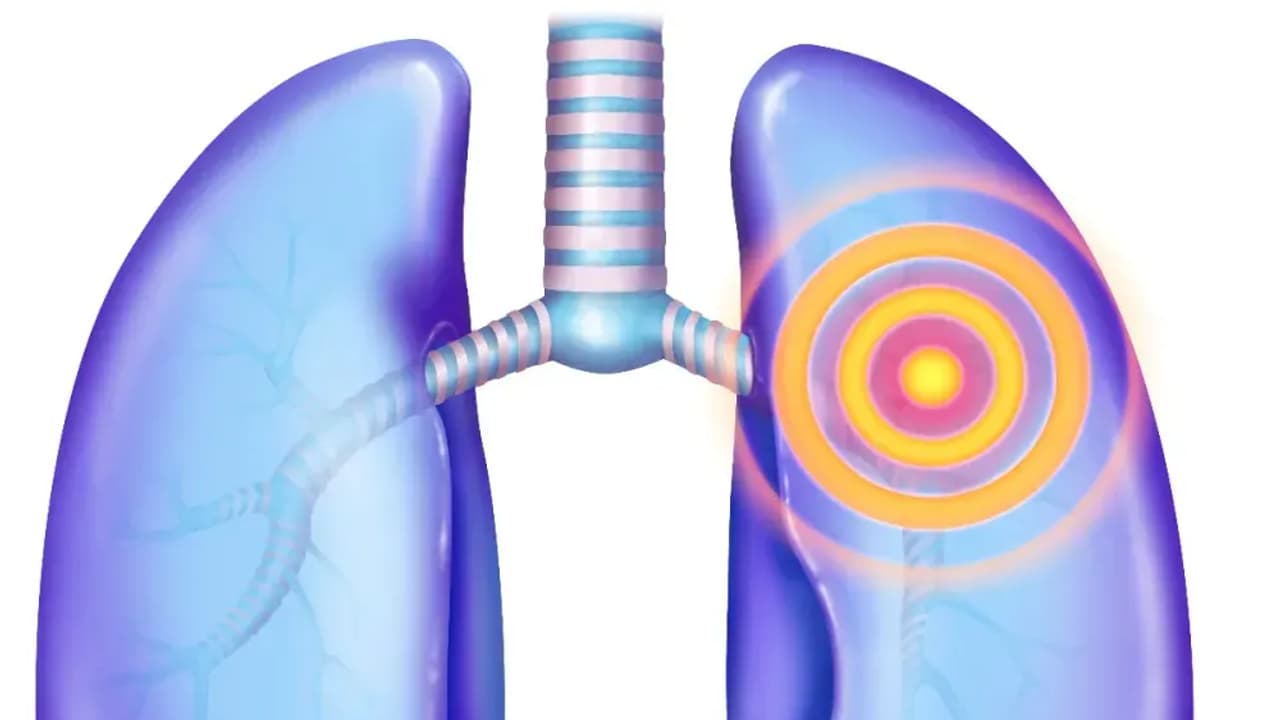 Black Diamond Therapeutics Shares Jump On New Partnership With France Based Servier: Retail Sentiment Hits Year High
