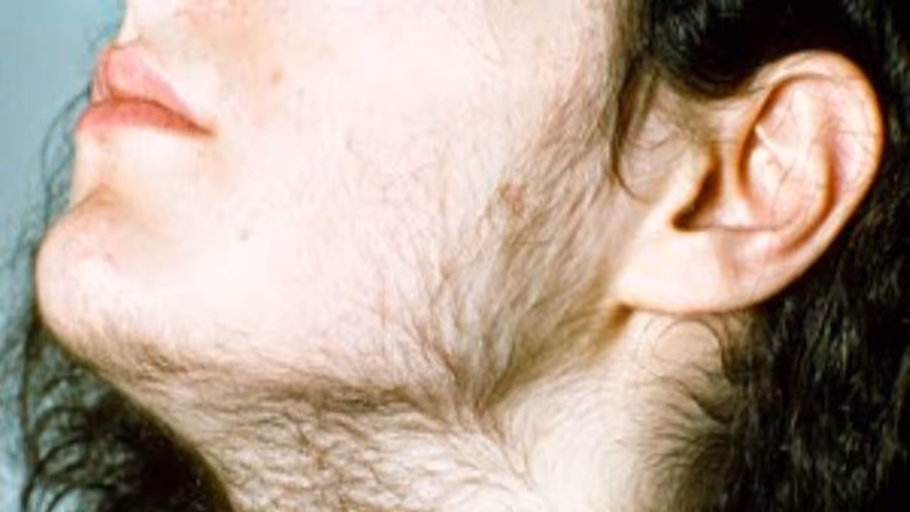 ஐந்து நிமிடத்தில் முகத்தில் உள்ள சிறு ரோமங்களை நீக்குவது எப்படி ..? ஐந்து நிமிடத்தில் முகத்தில் உள்ள சிறு ரோமங்களை நீக்குவது எப்படி ..?