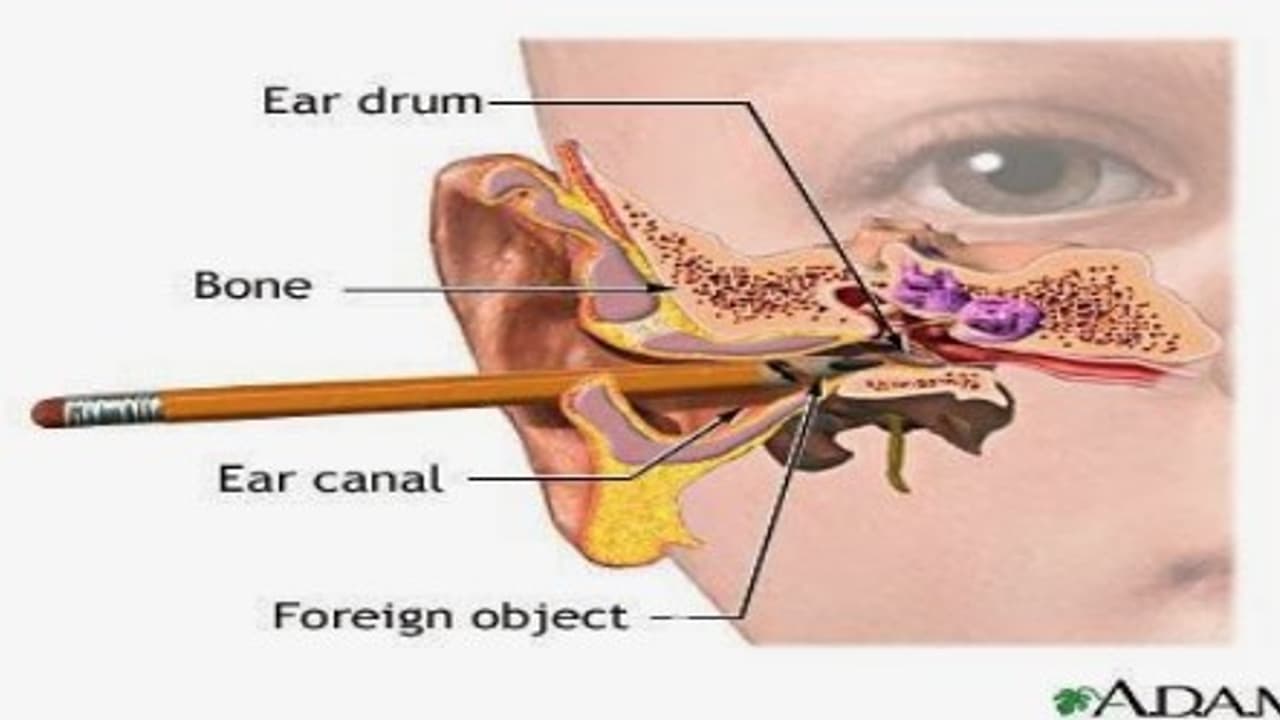 உங்களுக்குத் தெரியுமா? காதுக்குடுமியை அகற்ற நீங்கள் செய்யும் இந்த செயல்கள் உங்கள் காதுக்கு மிகவும் ஆபத்தானது… உங்களுக்குத் தெரியுமா? காதுக்குடுமியை அகற்ற நீங்கள் செய்யும் இந்த செயல்கள் உங்கள் காதுக்கு மிகவும் ஆபத்தானது…
