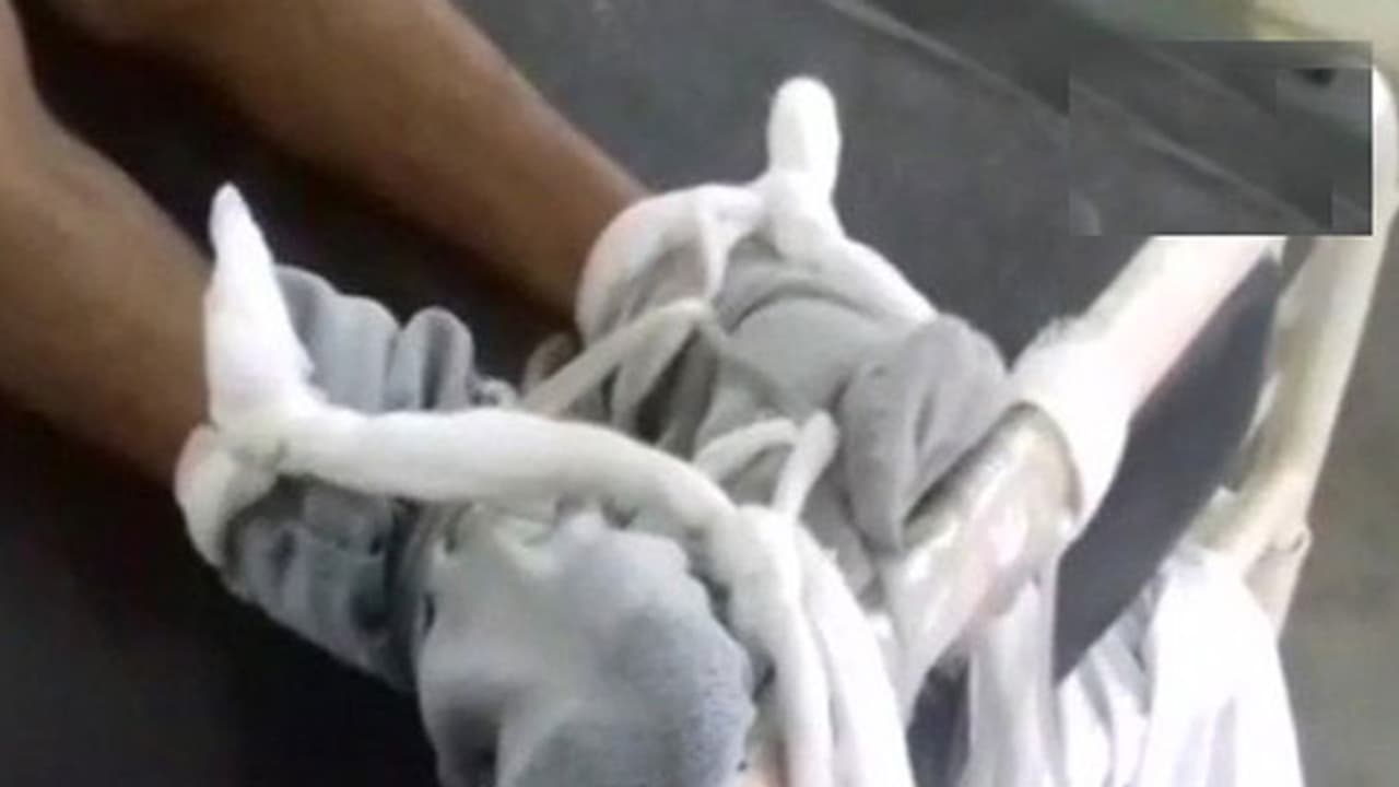 യുപിയില് രോഗിയെ കട്ടിലില് കെട്ടിയിട്ടു യുപിയില് രോഗിയെ കട്ടിലില് കെട്ടിയിട്ടു