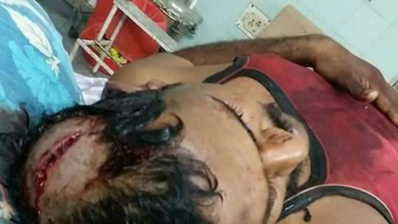 Sand mafia flexes its muscle again: Reporter brutally assaulted for covering Andhra story Sand mafia flexes its muscle again: Reporter brutally assaulted for covering Andhra story